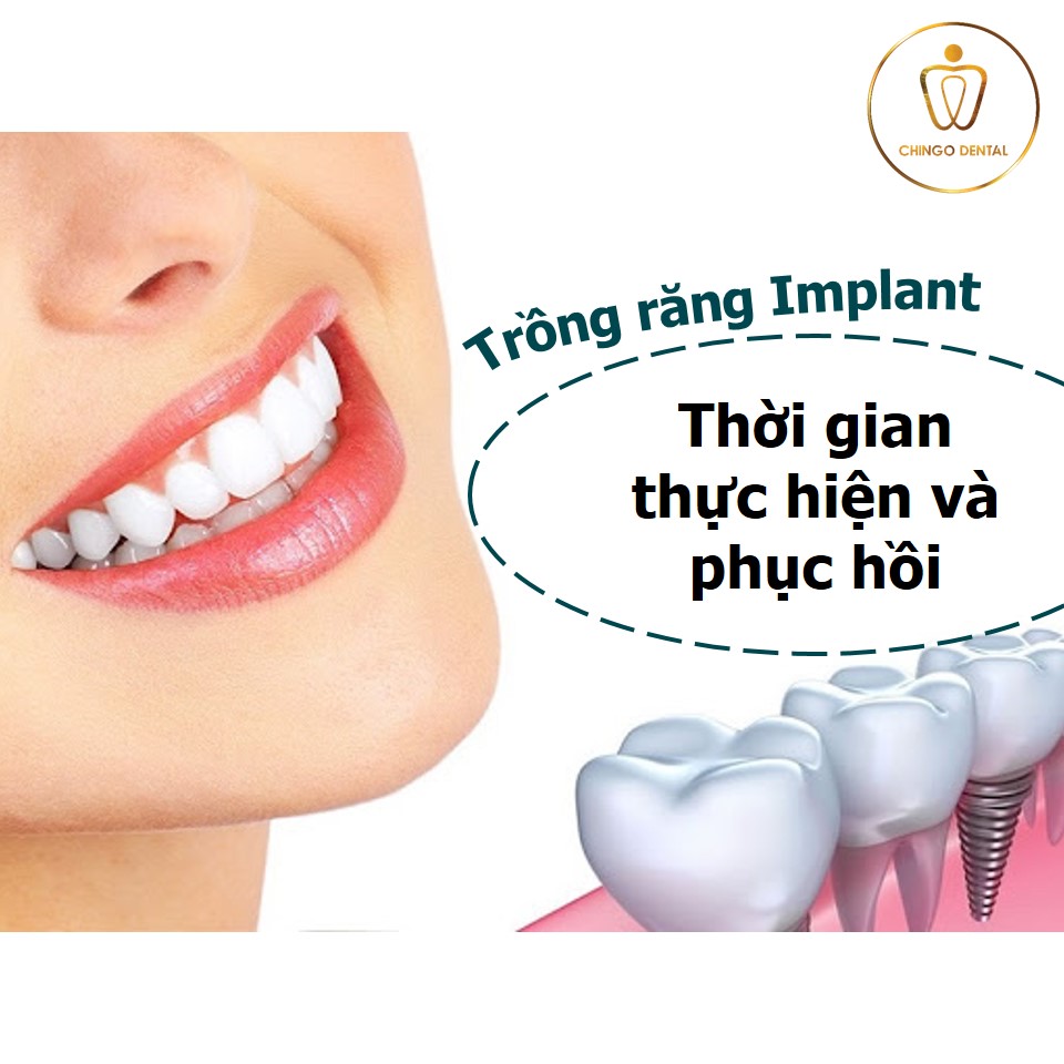 trong-rang-implant-thoi-gian-thuc-hien-chingo-dental-10