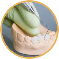 B4-boc-rang-su-chingo-dental-200x200