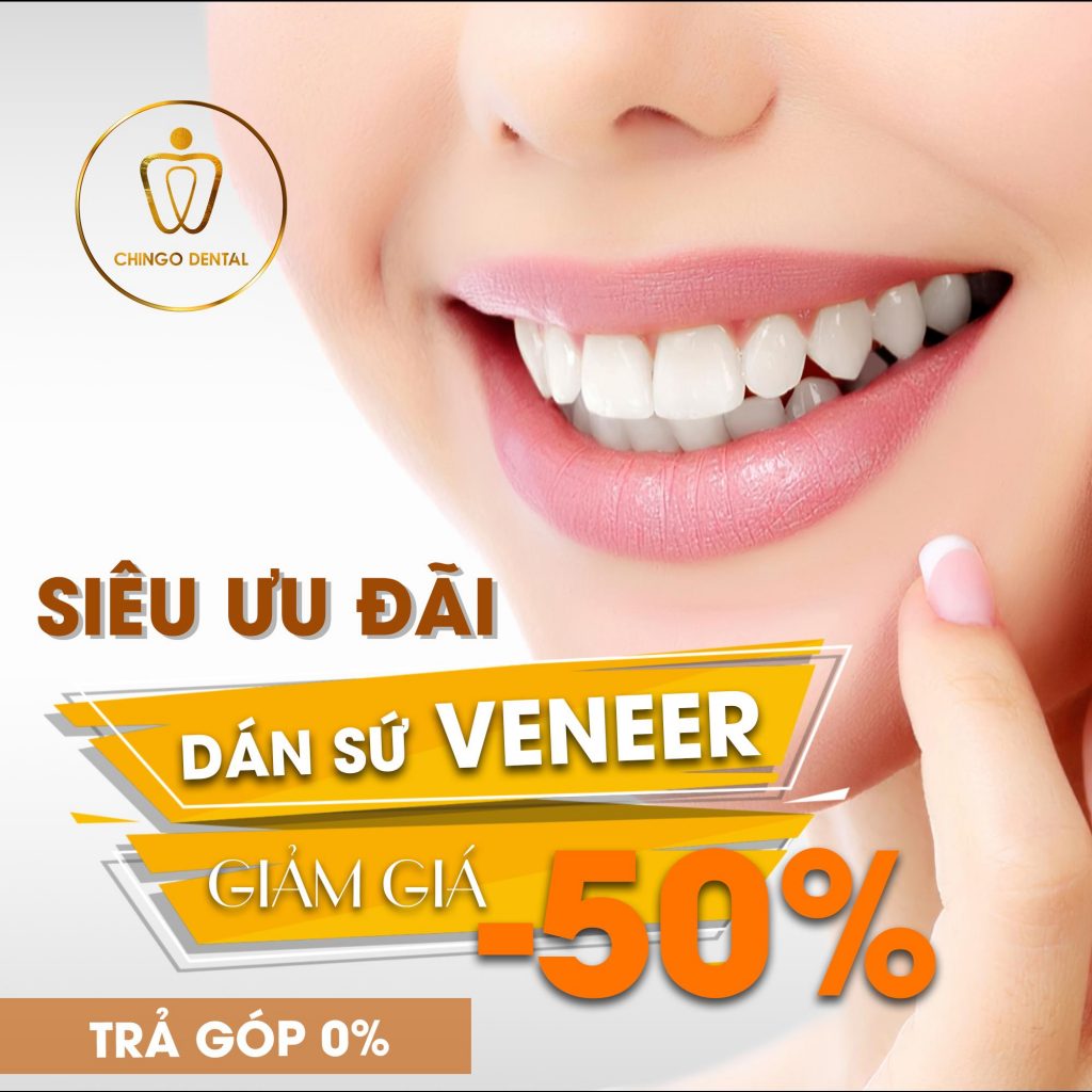 km-uu-dai-dan-su-veneers