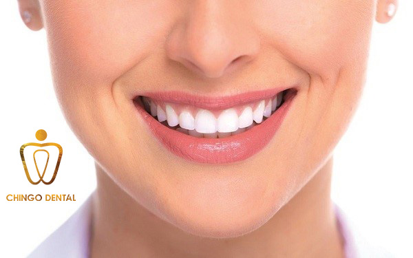 Niềng Răng Là Gì? Chi Phí Và Những Câu Hỏi Thường Gặp Về Niềng Răng boc-rang-su-la-gi