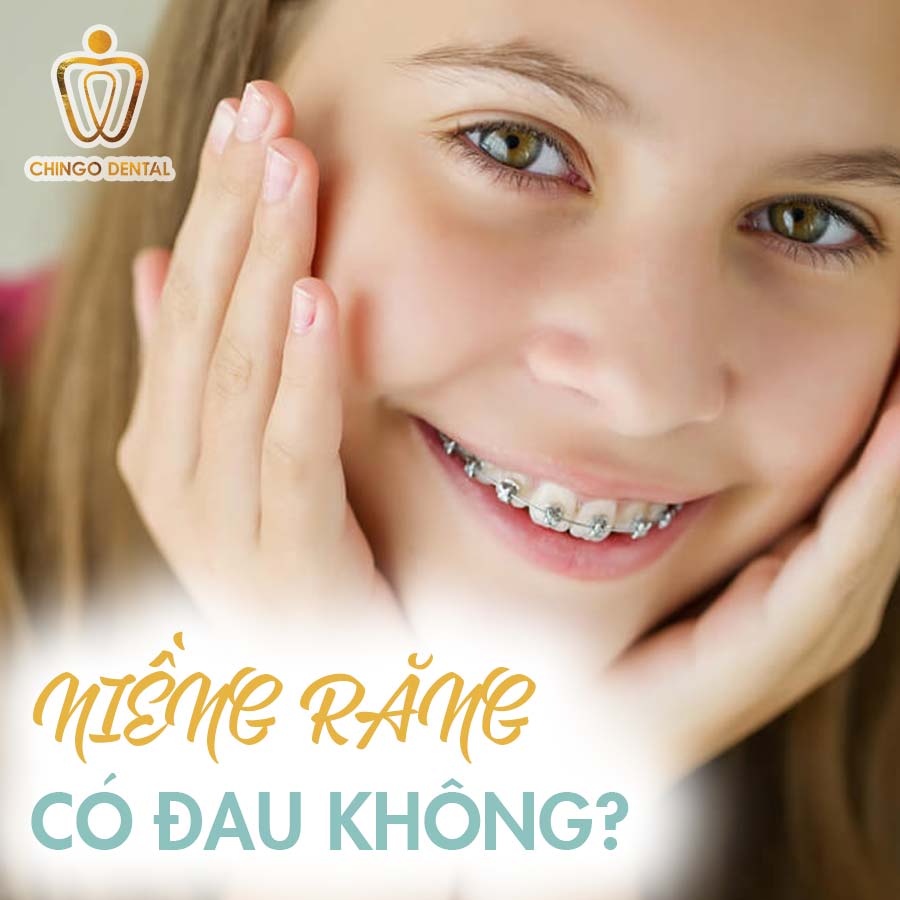 Niềng răng có đau không phụ thuộc vào các yếu tố nào? 2 nieng-rang-co-dau-khong-web
