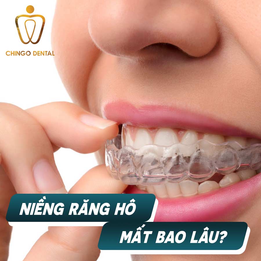 Niềng răng hô mất bao lâu thì đẹp? 9 nieng-rang-ho-FINAL-chingo