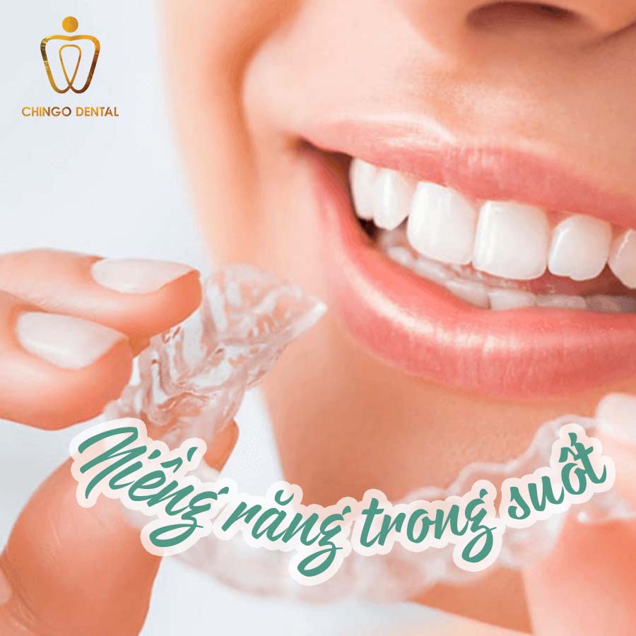 Niềng răng trong suốt và những kiến thức cần biết 5 nieng-rang-trong-suot-web-chingo-dental