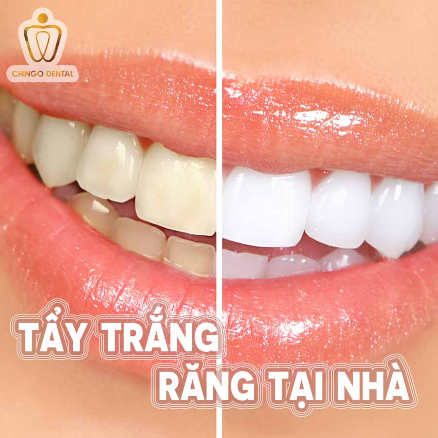 tay-trang-rang-tai-nha-chingo-60kb