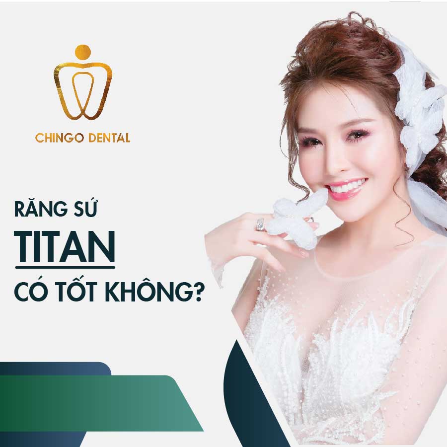 Có Nên Làm Răng Sứ Titan Không? Cẩm Nang Toàn Diện Với Phân Tích Từ Chuyên Gia 11 RANG-SU-TITAN-CO-TOT-KHONG