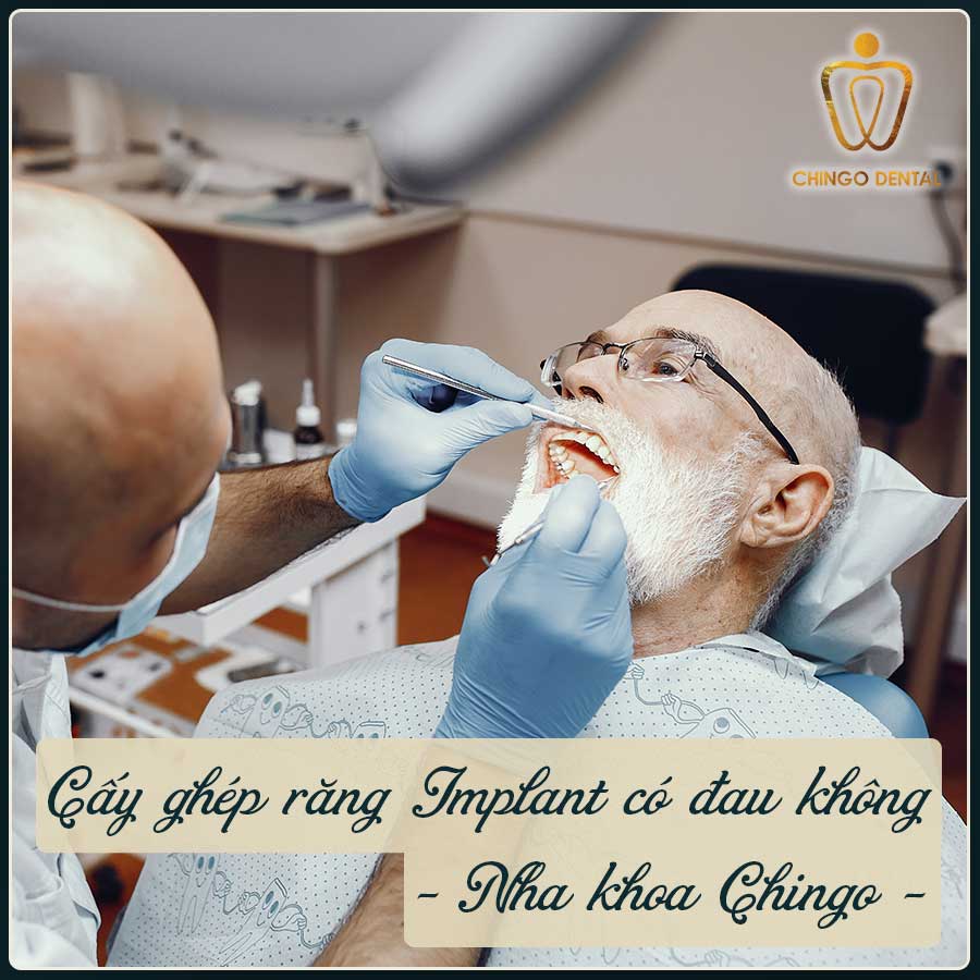 Cay Ghep Rang Implant Co Dau Khong Chingo Dental