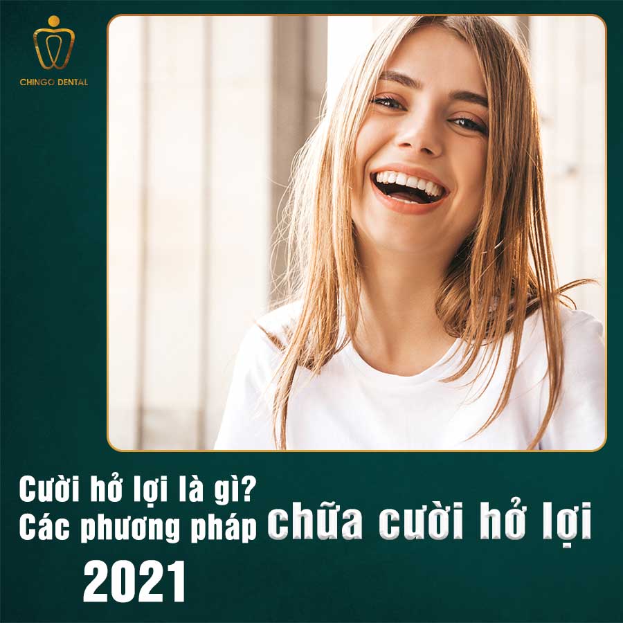 Chữa Cười Hở Lợi - Các Giải Pháp Điều Trị An Toàn, Không Tái Phát 7 Chua Cuoi Ho Loi Chingo Dental
