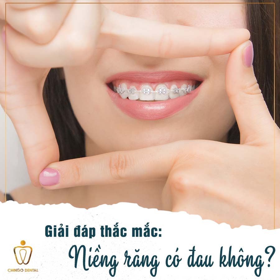 Niềng răng có đau không? – Giải đáp thắc mắc 10 Nieng Rang Co Dau Khong Chingo Dental