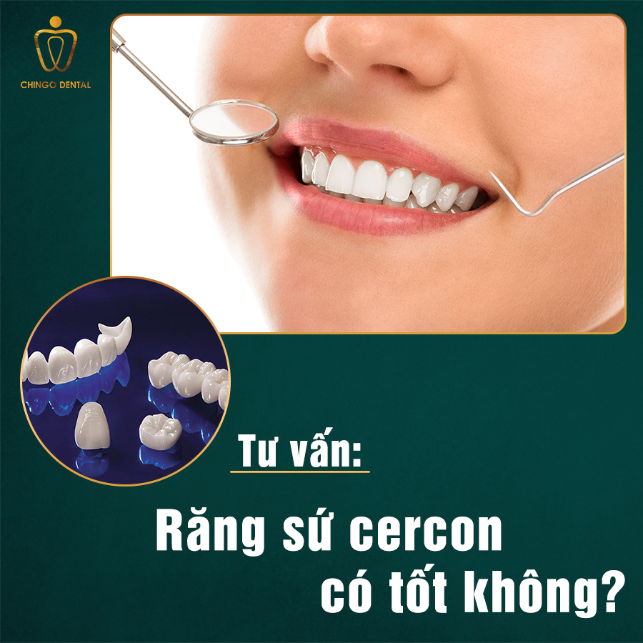 Răng sứ Cercon có tốt không? - Chingo Dental 4 Rang Su Cercon Co Tot Khong Chingo Dental
