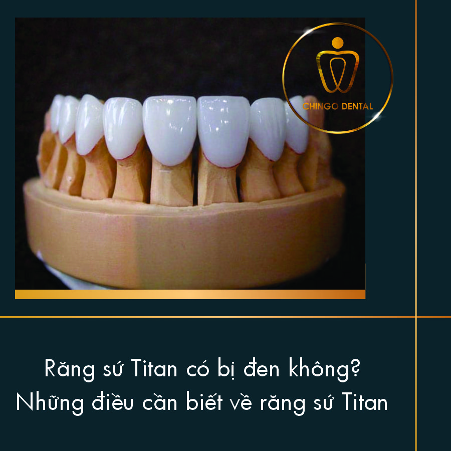 Răng sứ Titan có bị đen không? 7 Rang Su Titan Co Bi Den Khong Chingo Dental