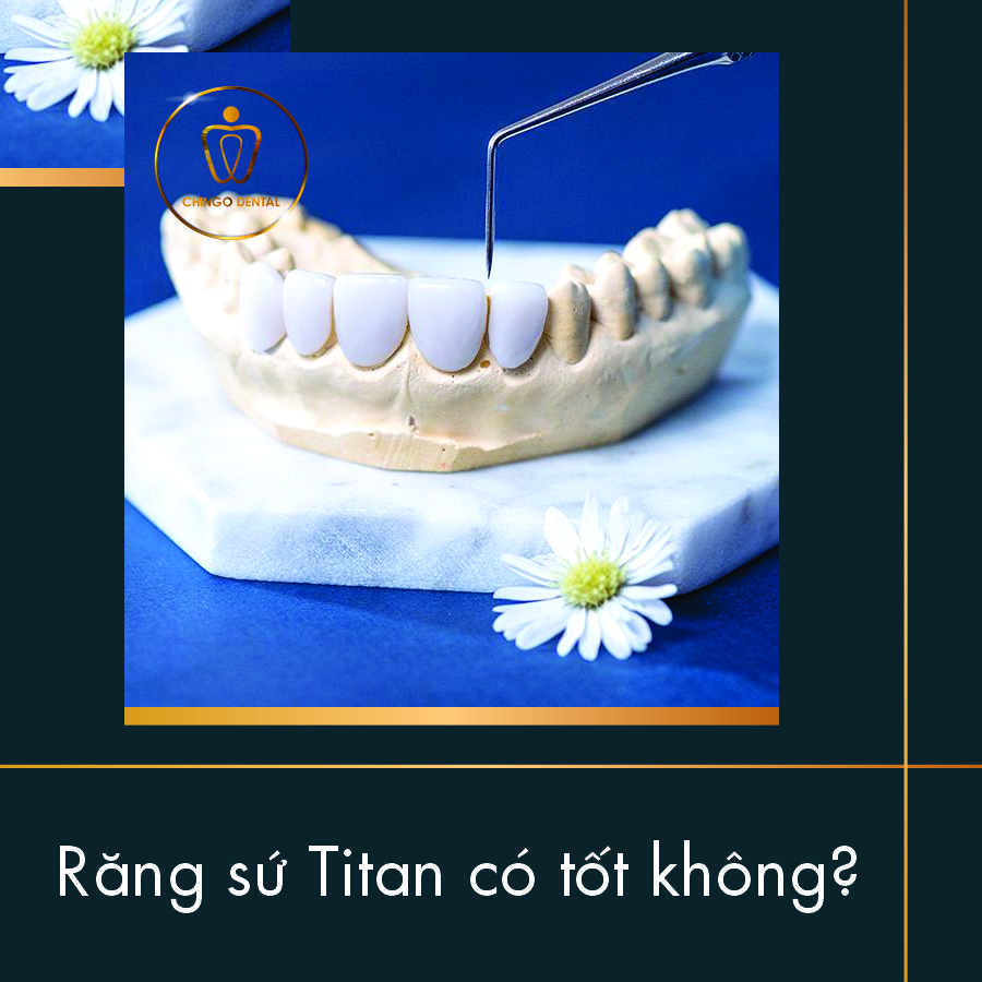 Răng sứ Titan có tốt không? 1 vài điều bạn nên lưu ý 9 Rang Su Titan Co Tot Khong