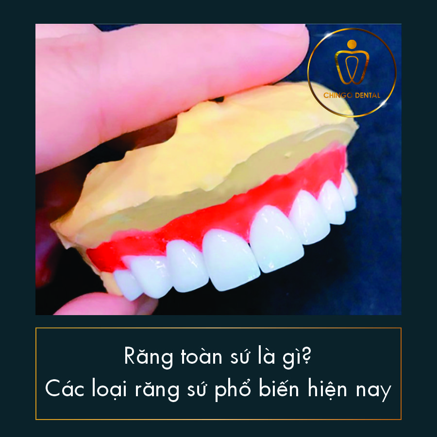 Răng toàn sứ là gì? Các loại răng toàn sứ phổ biến hiện nay? 6 Rang Toan Su Chingo Dental