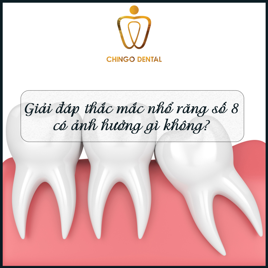 nho rang so 8 co anh huong gi chingo dental
