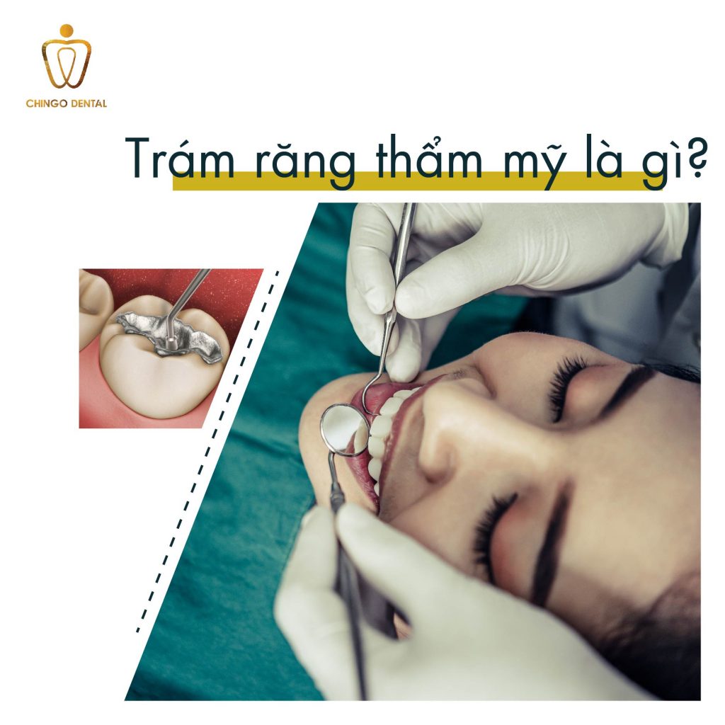 Tram Rang Tham My Chingo Dental