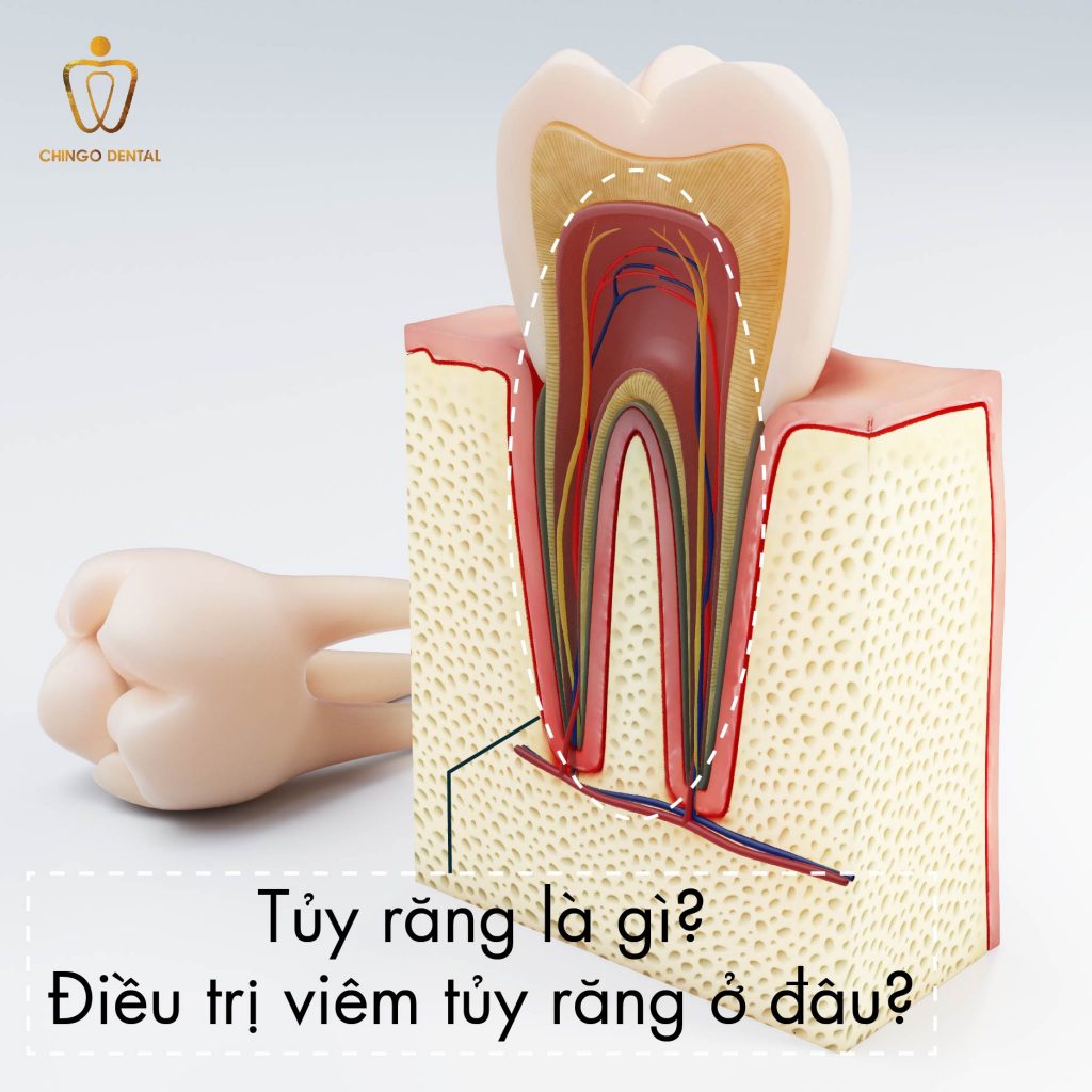 Tuy Rang Chingo Dental 4