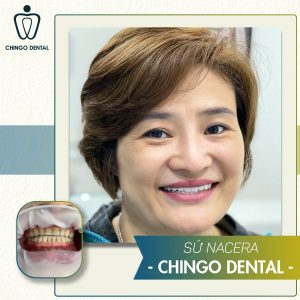 200104 Nhat Hong 20 Nacera Min