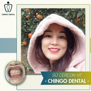 23214 Do Thi Thuy 22cercon Min