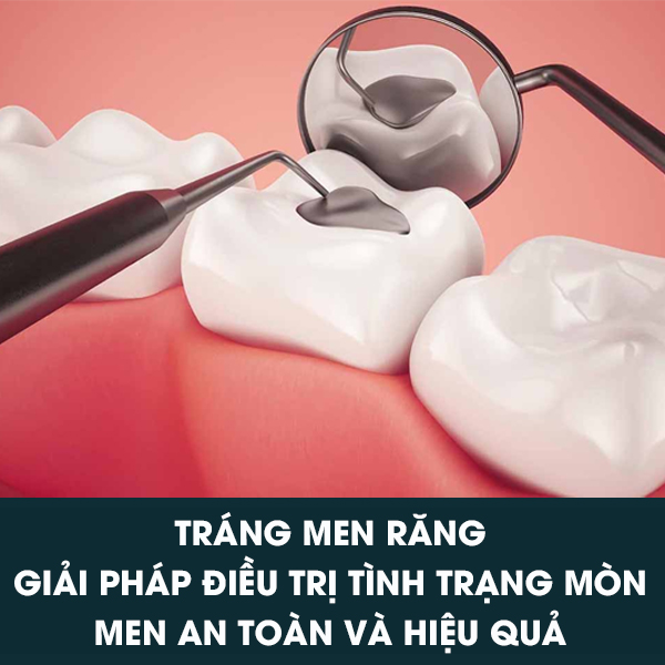 Trang Men Rang Chingo Dental