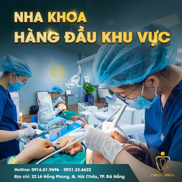 Chingo Dental - Nha khoa hàng đầu khu vực