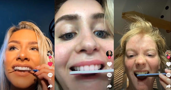 Ban Tin Nha Khoa So 6 Chingo Dental 3