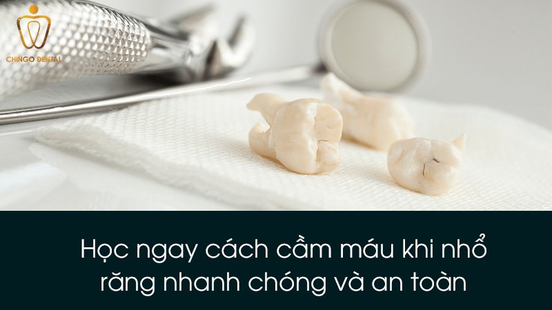 cach cam mau khi nho rang chingo dental 1