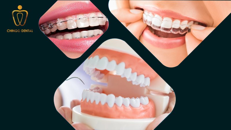 nep rang chingo dental 1