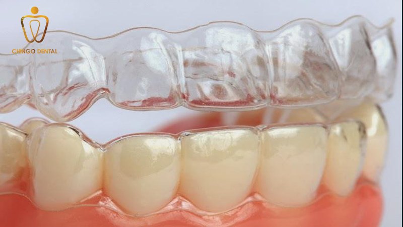 nep rang chingo dental 2