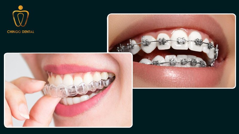 nep rang chingo dental 3