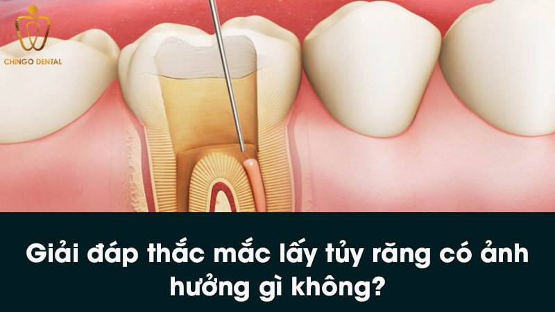 3141b1866e499917c058