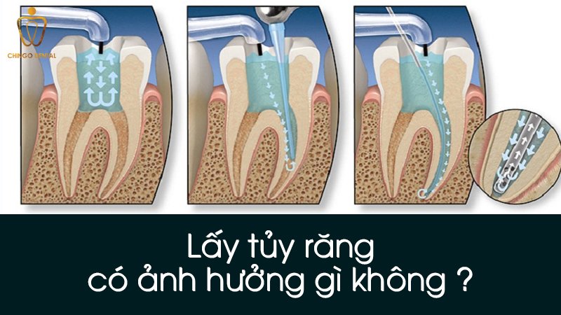 4fc0140e12c0e59ebcd1