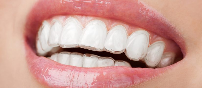 ban tin nha khoa so 7 chingo dental 3