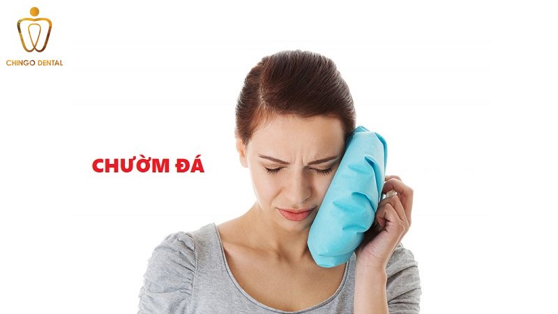 moc rang khon bi sung ma chingo dental 4