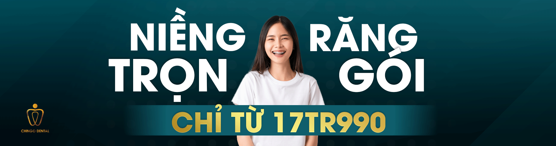 Niềng Răng Là Gì? Chi Phí Và Những Câu Hỏi Thường Gặp Về Niềng Răng 1 nieng rang