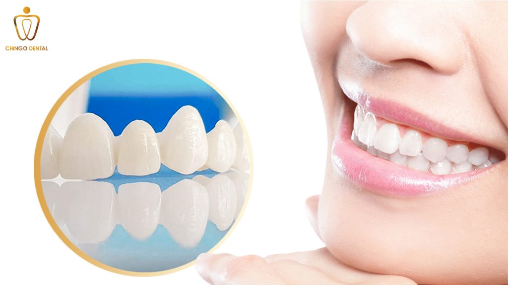 gia-rang-su-zirconia