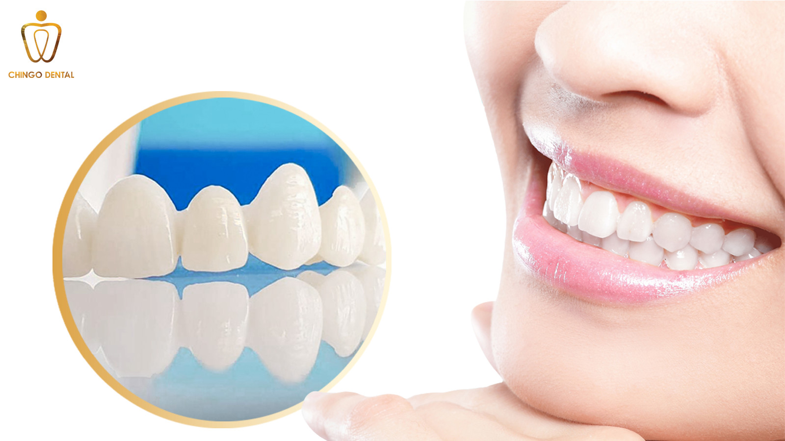 gia-rang-su-zirconia