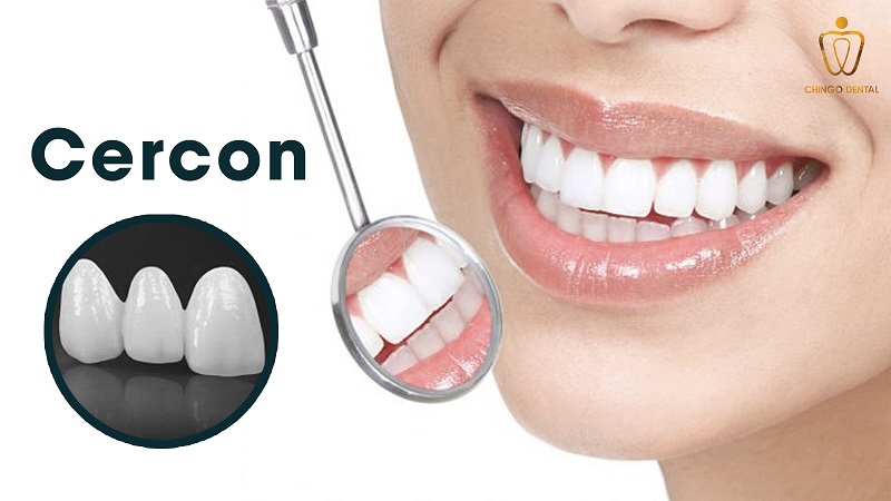 rang-su-cercon-co-tot-khong