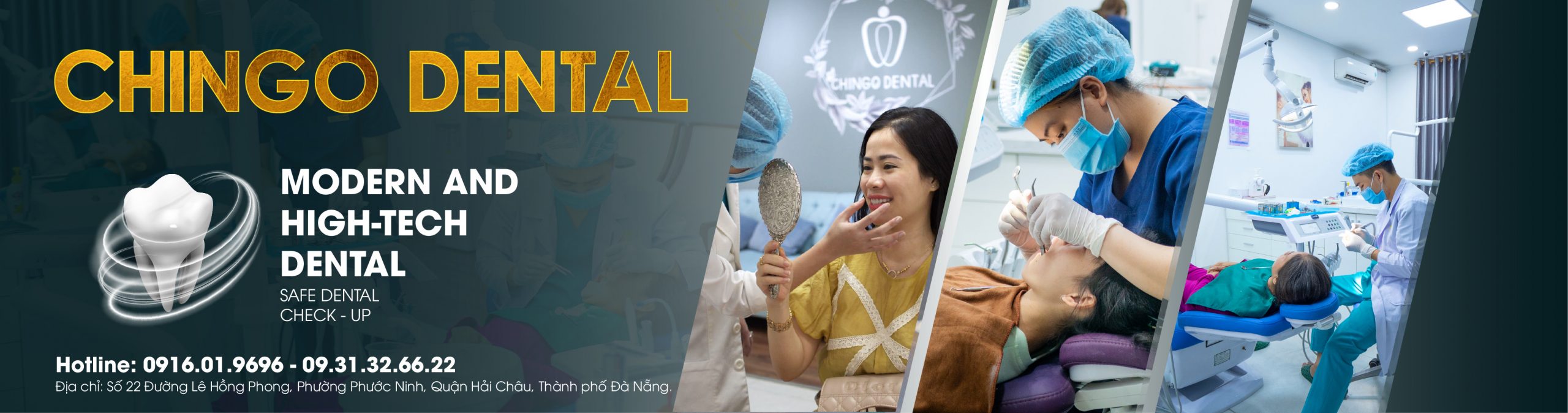Về CHINGO DENTAL 1 banner-ve-chingo-dental