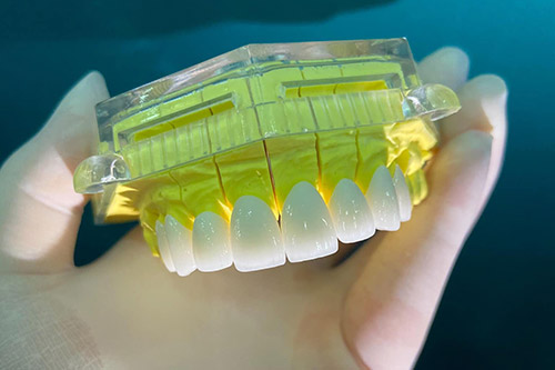 boc rang su chingo dental