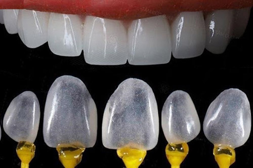 dan-su-tai-nha-khoa-chingo-dental