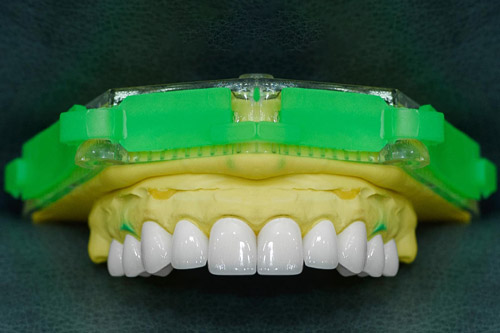 km-boc-rang-su-chingo-dental