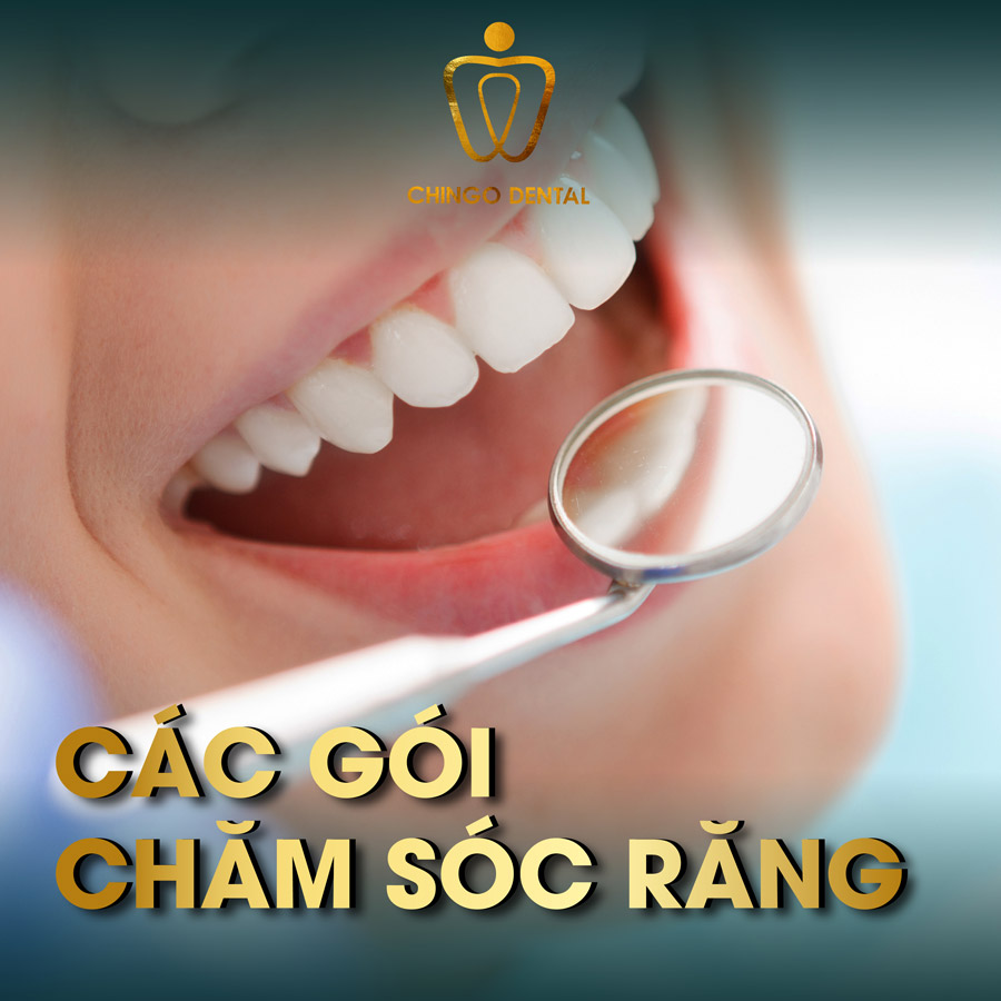 Chingo Dental Các gói chăm sóc răng