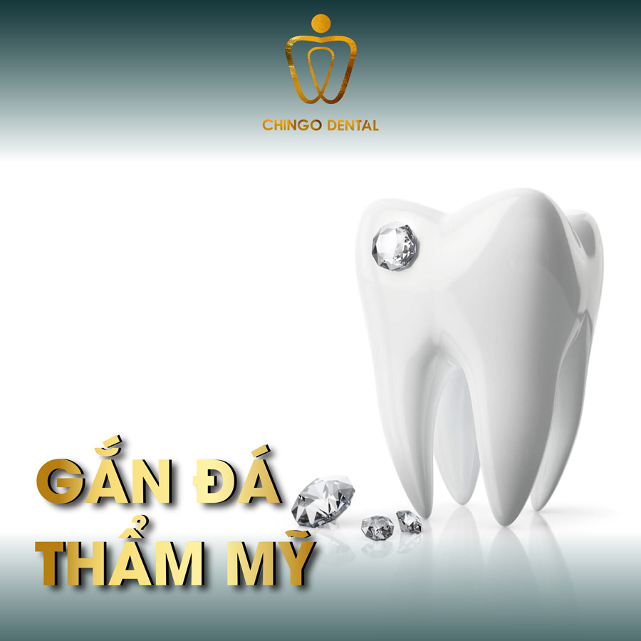 chingo dental gan da tham my
