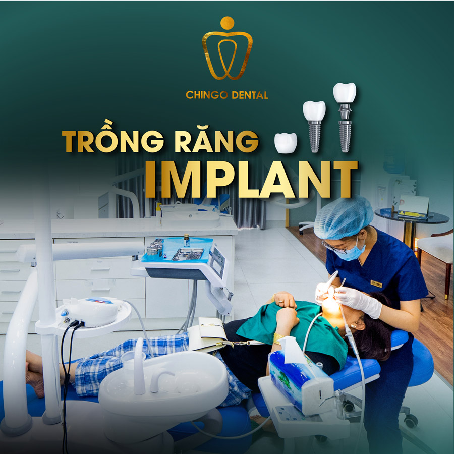 Chingo Dental Implant