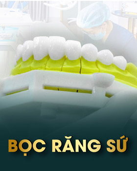 Bọc răng sứ