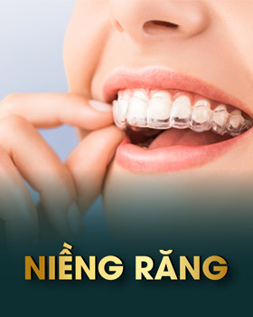 Niềng răng