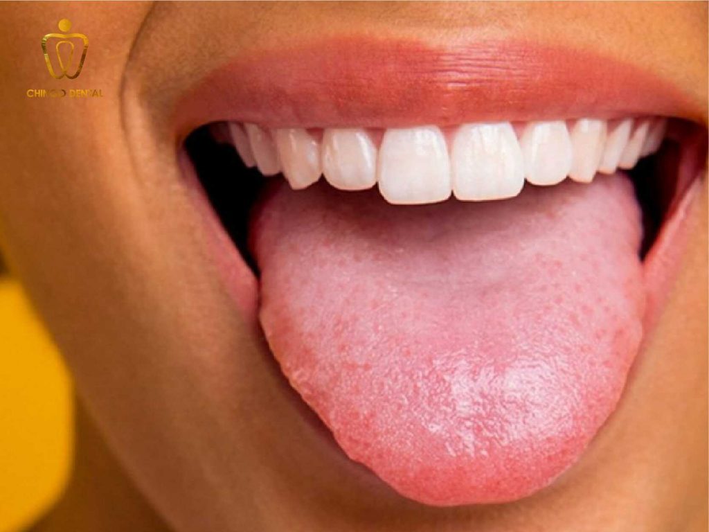 bai 1 01 04 min optimized