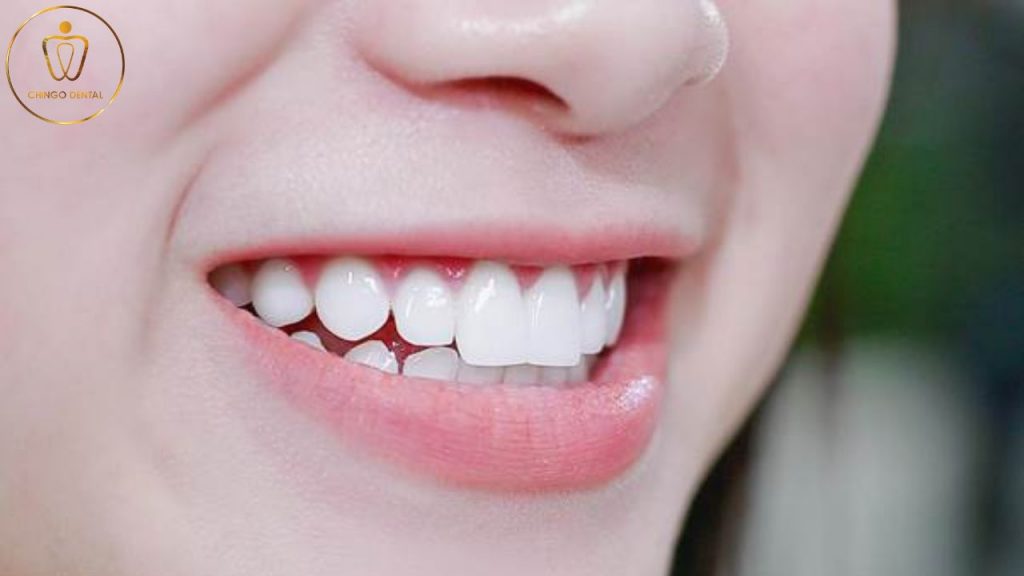 rang su co the duy tri tron doi