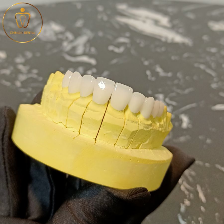 rang toan su chingo dental