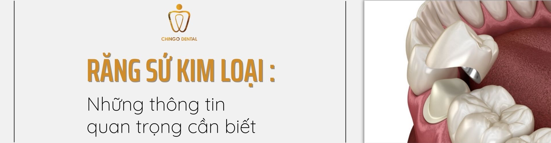 Cap Nhat Thong Tin Ve Rang Su Kim Loai Moi Nhat 2023