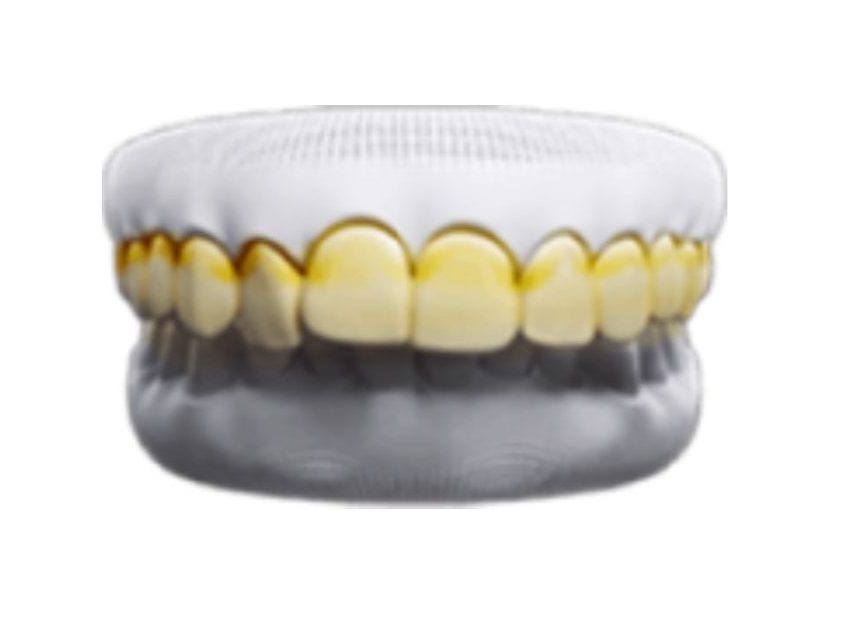 Bi vem nuou va tut loi e1703300764525